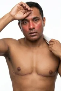 HRT hot flashes APS